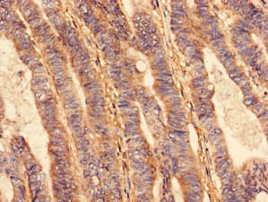 Polyclonal Rabbit anti-Human VPS26B Antibody