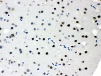 Polyclonal Rabbit anti-Human SNRPN Antibody (IHC, WB)