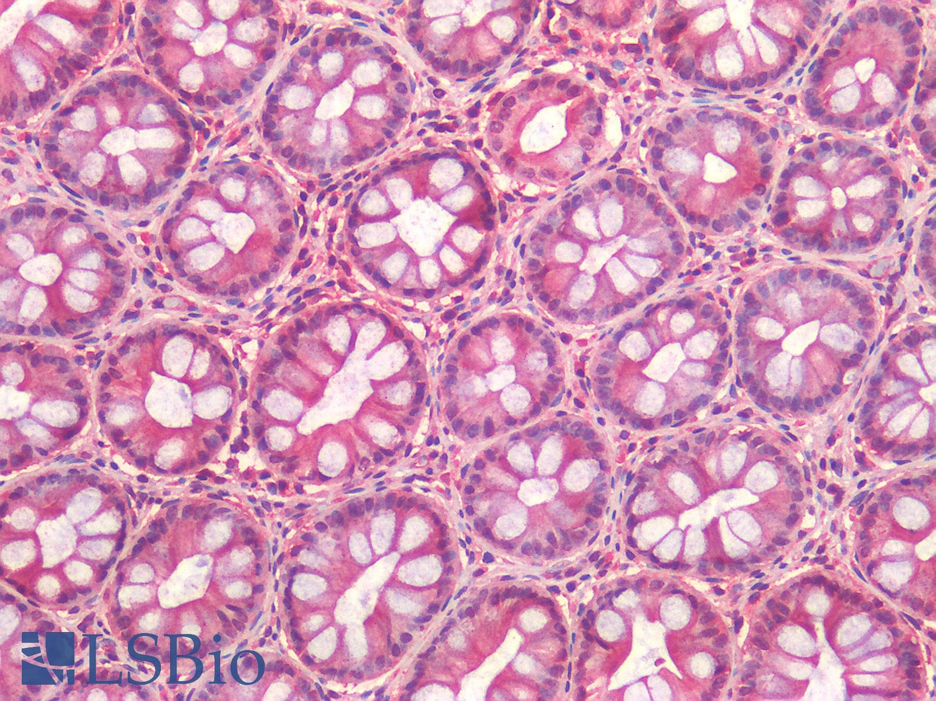 IHC-plus™ CX3CL1 / Fractalkine Antibody