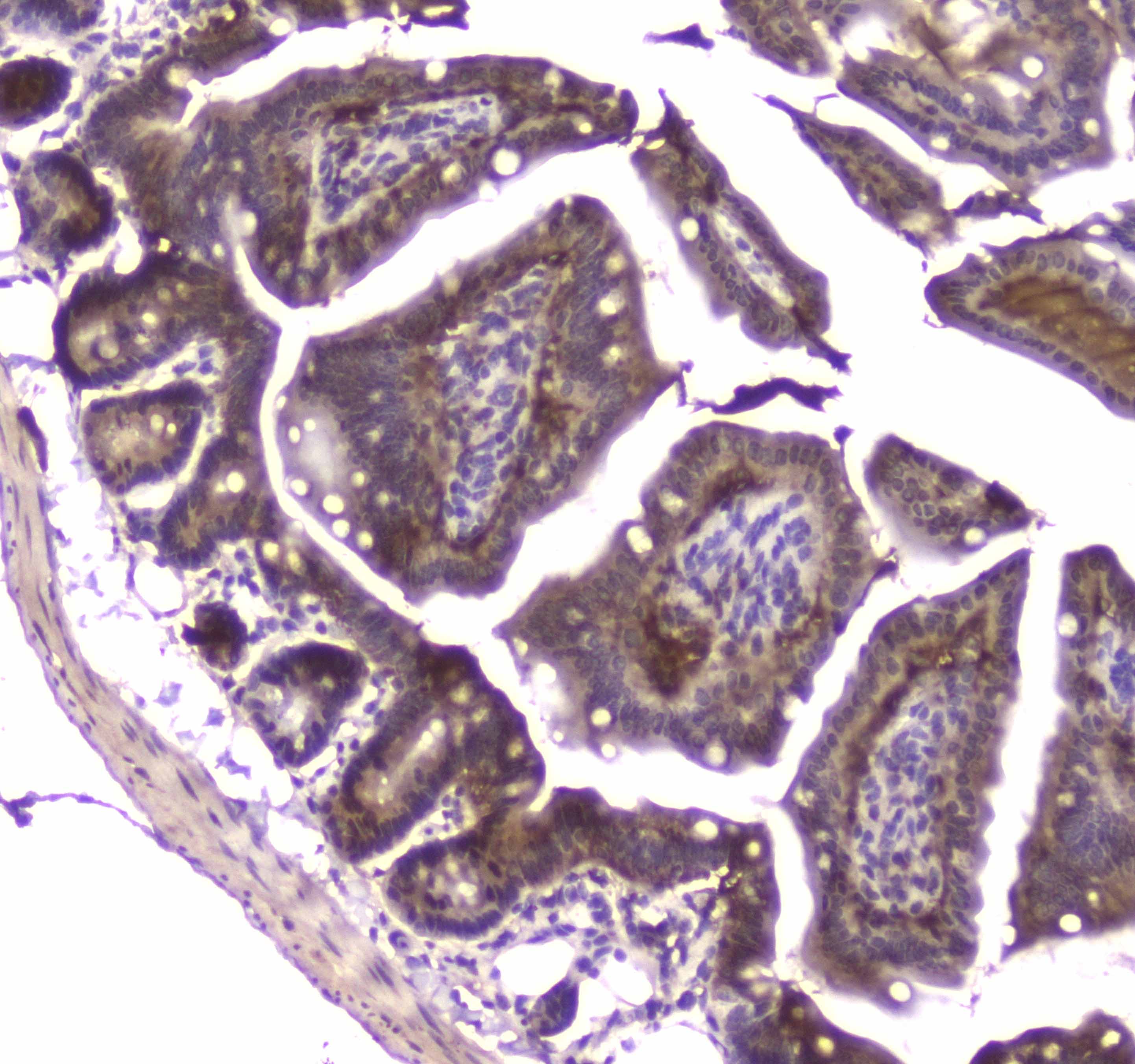 MVP / VAULT1 Antibody