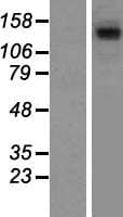 STAG1 / SA1 Protein (Over-Expression Lysate Myc-DDK (Flag))
