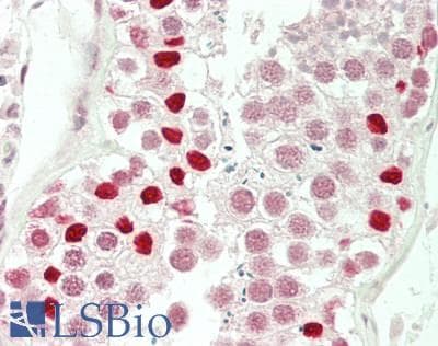 IHC-plus™ Polyclonal Rabbit anti-Human DNMT3B Antibody (aa7-56, IHC, WB)