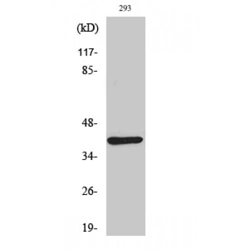 DOK4 Antibody (30-110 aa, N-terminal)