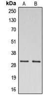 Polyclonal Rabbit anti-Human DNAJC5 / CSP Antibody (C-Terminus, WB)