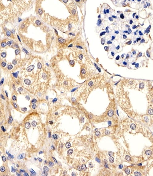 UBE2L3 / UBCH7 Antibody (aa106-135)