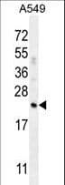 CFD / Factor D / Adipsin Antibody (aa68-99)