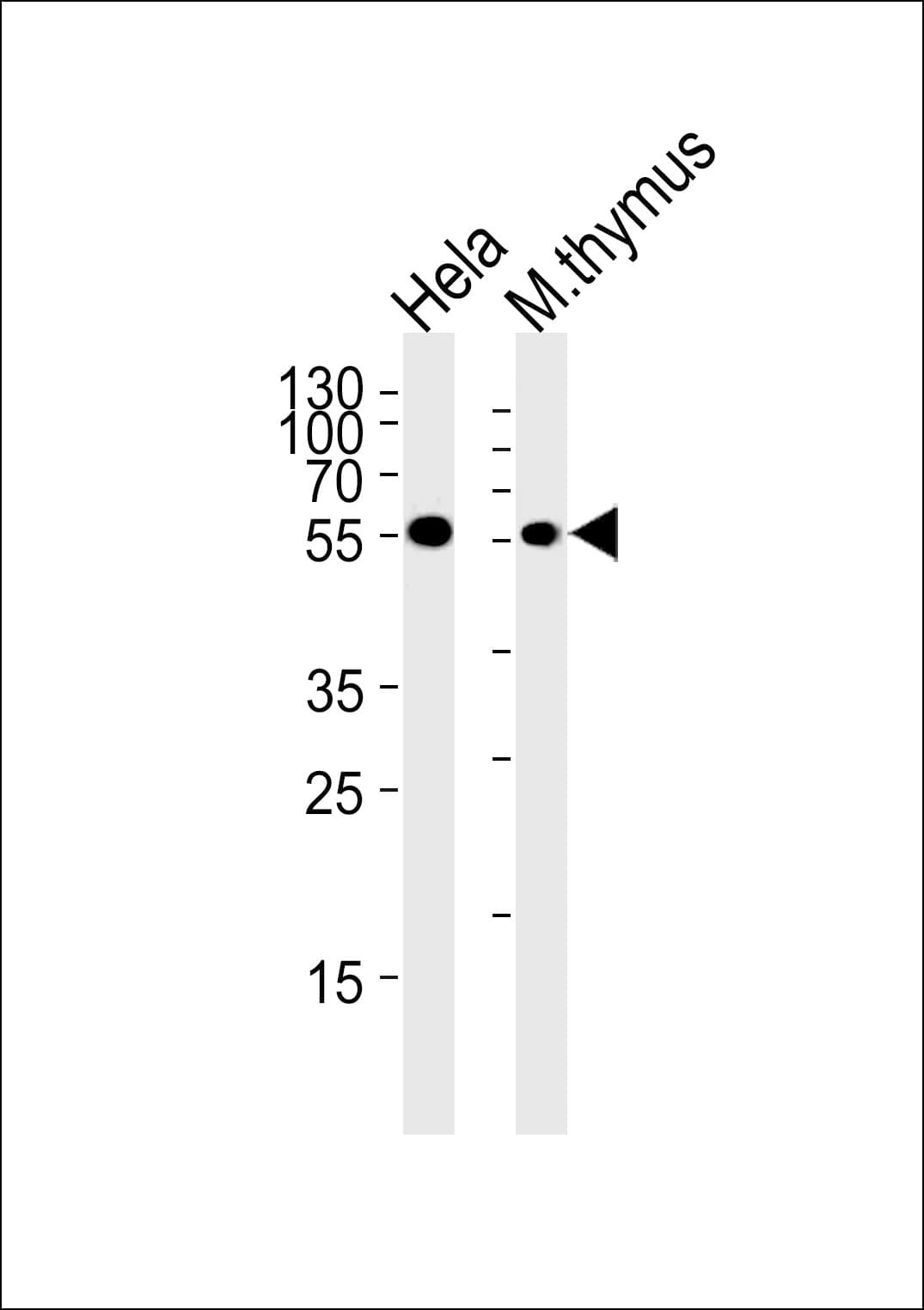 IHC-plus™ CHEK1 / CHK1 Antibody (Ser280)