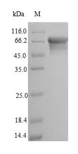 Rat ALPL / Alkaline Phosphatase Protein (Recombinant 6His-SUMO, N-terminus)