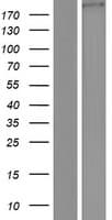 KIAA1217 Protein (Over-Expression Lysate Myc-DDK (Flag))