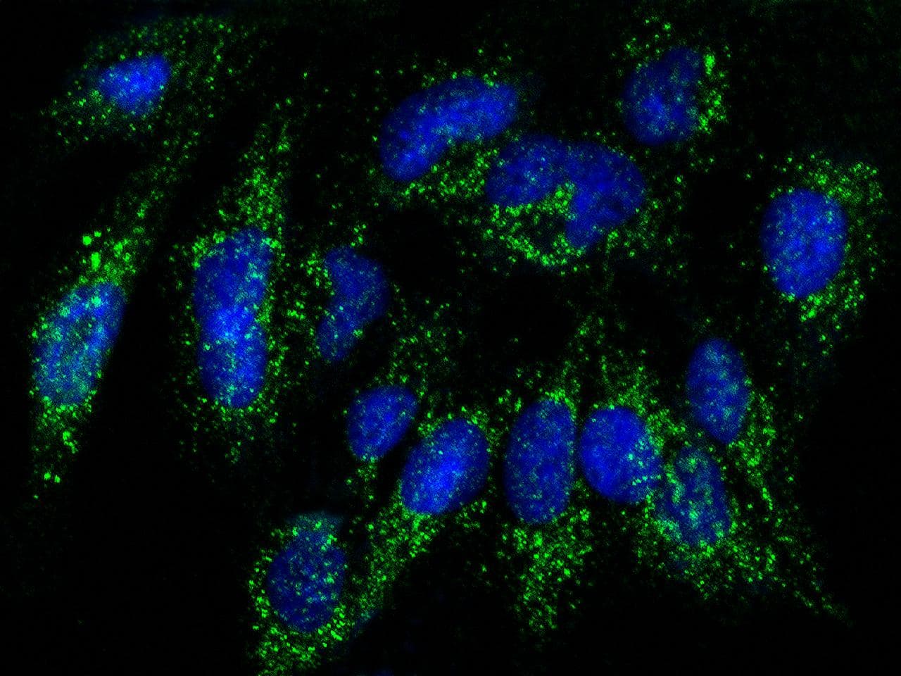 Polyclonal Rabbit anti-Human RAB27B Antibody (Preservative Free, IHC, IF)