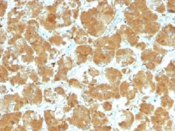 Monoclonal Mouse anti-Human TSH Receptor / TSHR Antibody (clone TSHRA/1402, Azide-free,BSA-free, IHC, IF)
