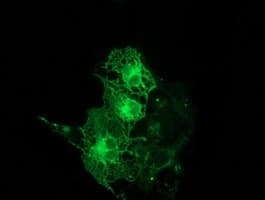 PRKCE / PKC-Epsilon Antibody (clone OTI4D12)