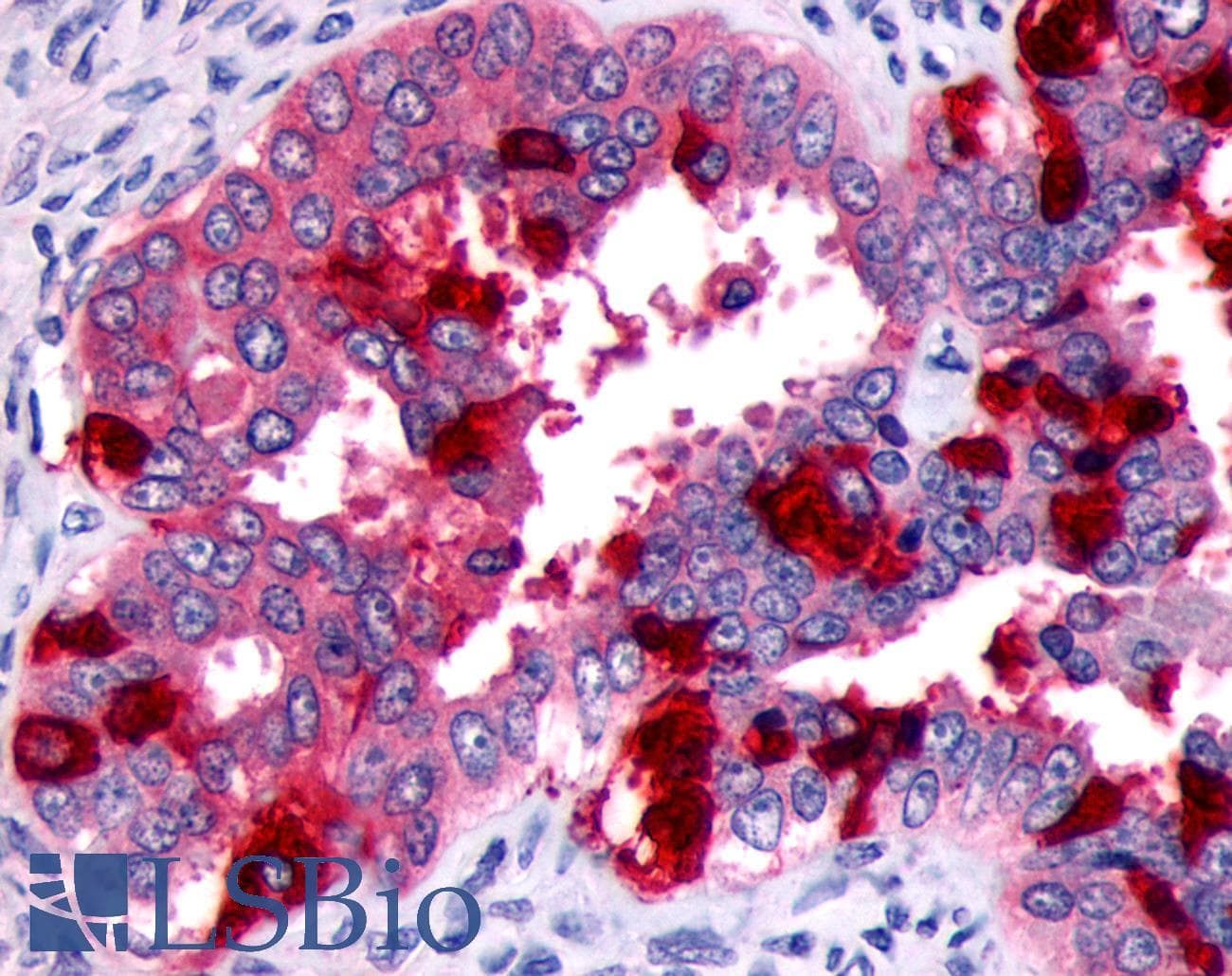 PathPlus™ FP / PTGFR Antibody (Extracellular Domain)