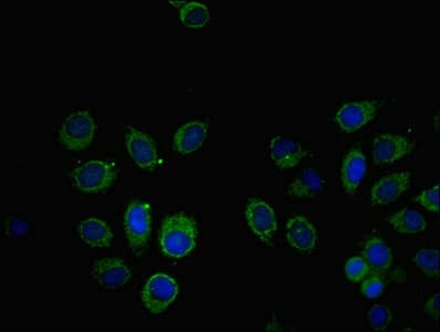 SOCS6 / SOCS-6 Antibody