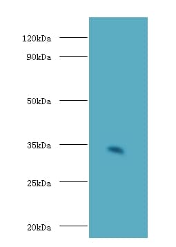 CD74 / CLIP Antibody