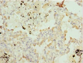 Polyclonal Rabbit anti-Human BTG1 Antibody (IHC)