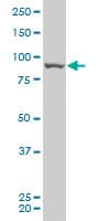 Monoclonal Mouse anti-Human RIP4 / ANKRD3 Antibody (clone 2D1, WB)