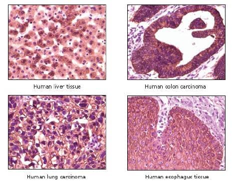 KRT1 / CK1 / Cytokeratin 1 Antibody (clone 3C10F7, 3C10G5)