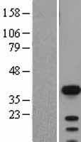 SOX2 Protein (Over-Expression Lysate Myc-DDK (Flag))