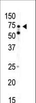 Polyclonal Rabbit anti-Human PRKAA2 / AMPK Alpha 2 Antibody (aa476-507, WB)
