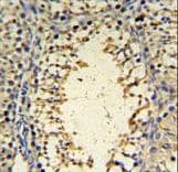 Polyclonal Rabbit anti-Human IMP3 Antibody (aa156-184, IHC, WB)