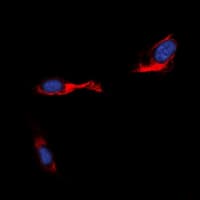 STEAP4 Antibody (Internal)