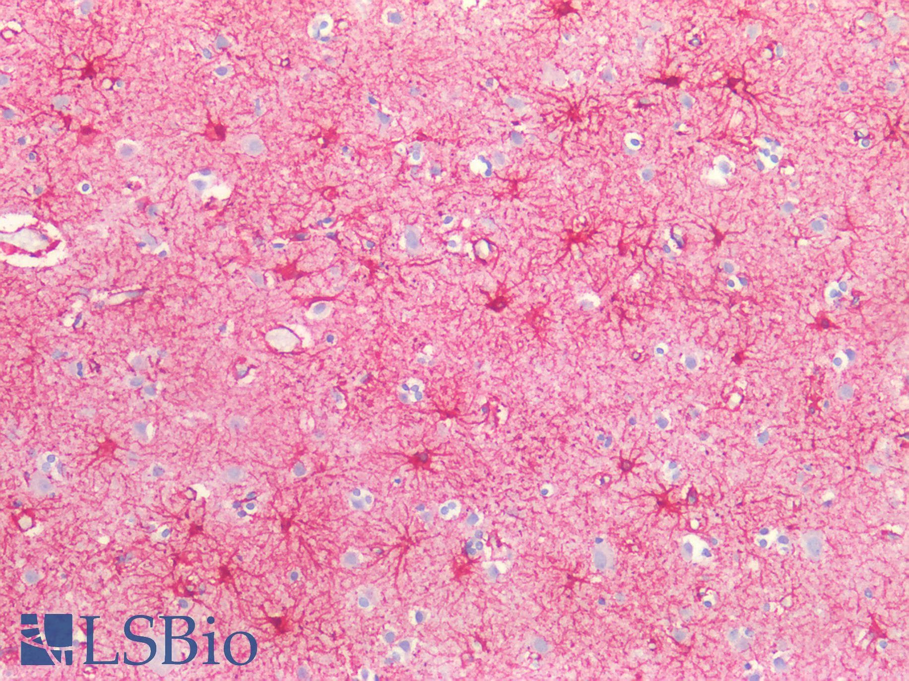 GFAP Antibody
