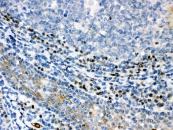 Polyclonal Rabbit anti-Human XBP1 Antibody (aa55-89, IHC, WB)
