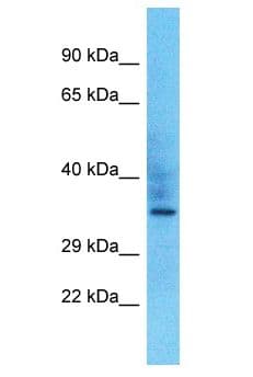 Polyclonal Rabbit anti-Human OR10P1 Antibody (aa211-260, WB)