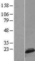 C1D Protein (Over-Expression Lysate Myc-DDK (Flag))
