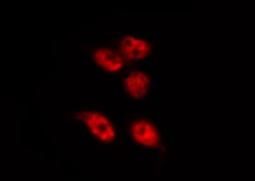 Polyclonal Rabbit anti-Human RBMX Antibody (IHC, IF, WB)