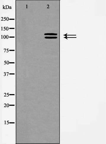 Polyclonal Rabbit anti-Human ACE2 / ACE-2 Antibody (IF, WB)