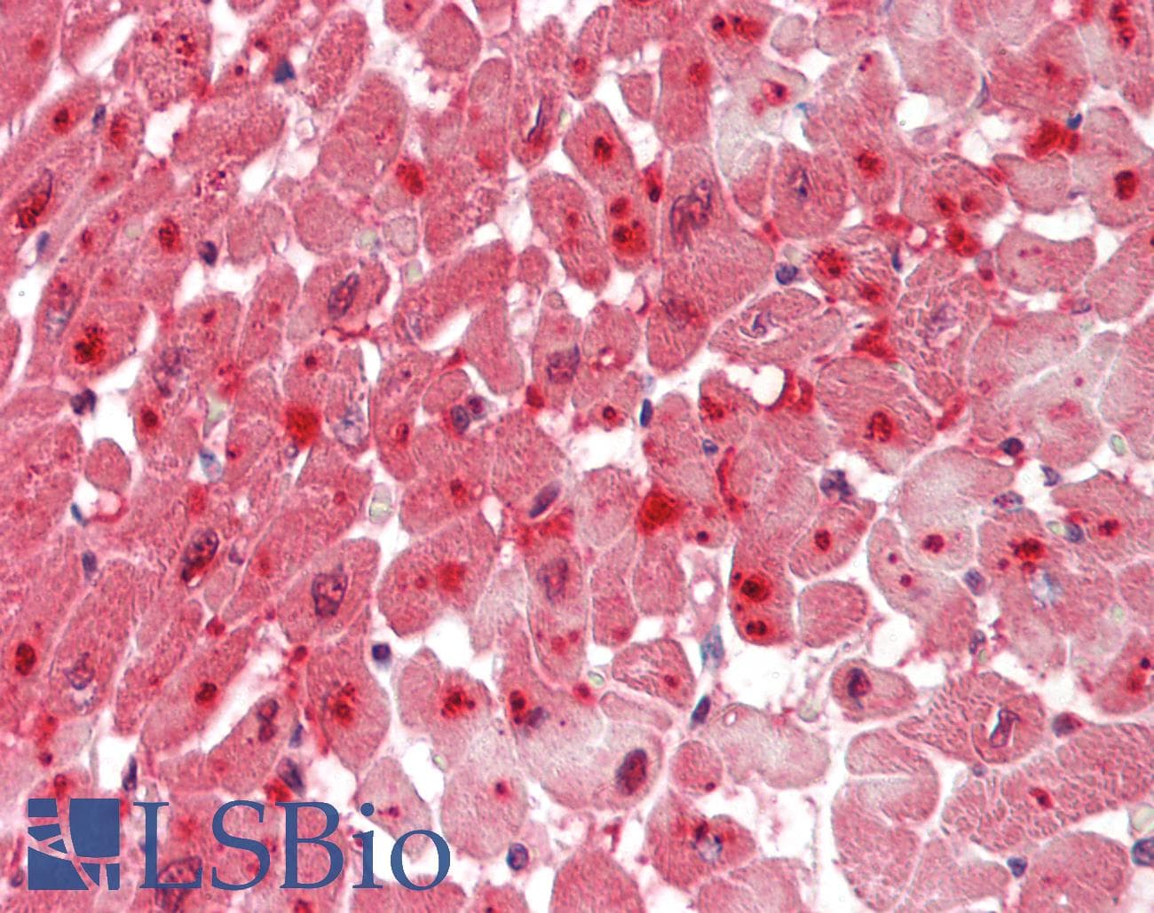 SCN4 / G6PC3 Antibody (aa86-135)