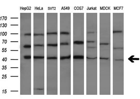 CASP4 / Caspase 4 Antibody (aa81-270, clone OTI4A2, Carrier-free)