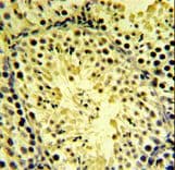 DGKK Antibody (aa1232-1261)