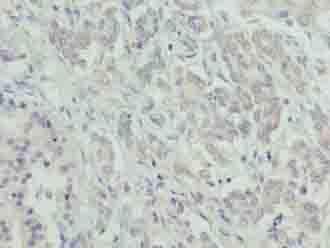 ATXN7L1 Antibody