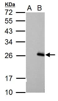 RGS17 / RGSZ2 Antibody (aa148-210)