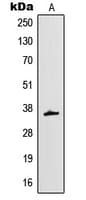 IHC-plus™ MT-ND1 Antibody (Internal)