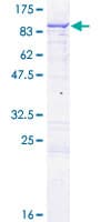 Human ENOX1 / CNOX Protein (Recombinant GST)