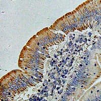 Polyclonal Rabbit anti-Human ACCS / ACS Antibody (IHC, IF, WB)