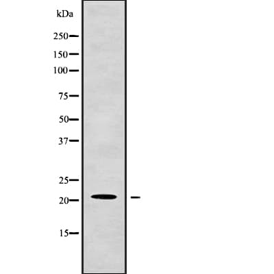 CSF3 / G-CSF Antibody