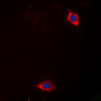 Polyclonal Rabbit anti-Human LAMA4 / Laminin Alpha 4 Antibody (Internal, IHC, IF, WB)