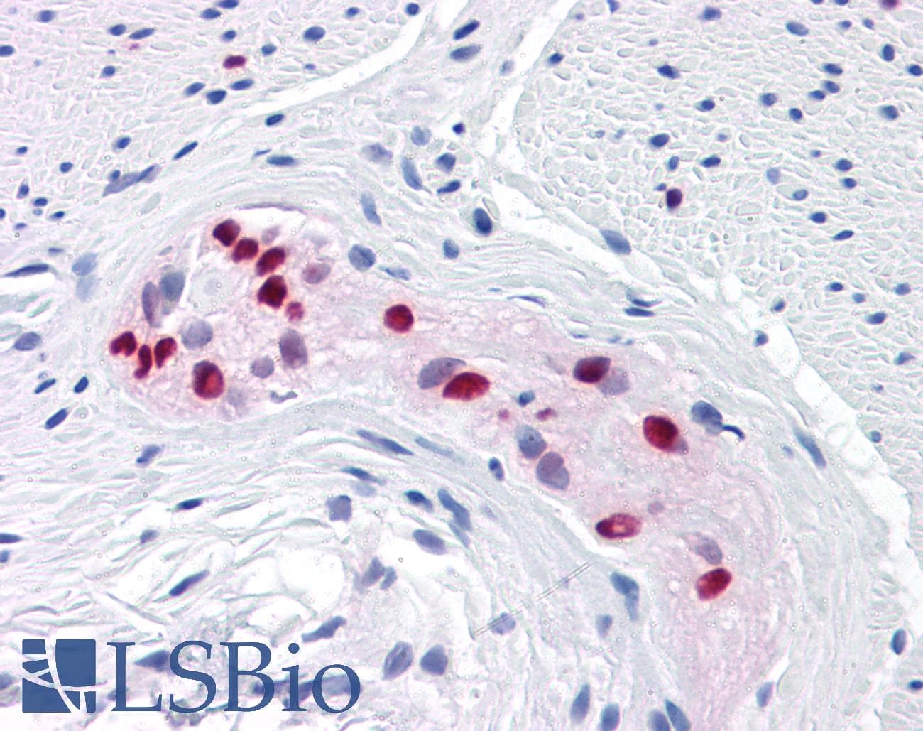 PathPlus™ Monoclonal Mouse anti-Human SOX9 Antibody (clone 3F11, IHC, IF, WB)