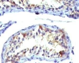 PRLR / Prolactin Receptor Antibody (clone ERSV8-1, Ready-to-Use)