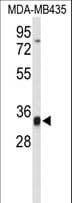 TFPT / Amida Antibody (aa60-88)