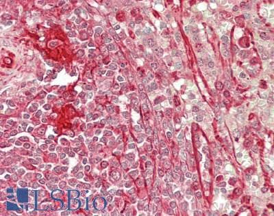 IHC-plus™ EFNA3 / Ephrin A3 Antibody (aa23-214, clone 4A4)