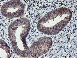 GRAP2 / GRID Antibody (clone OTI1G2)