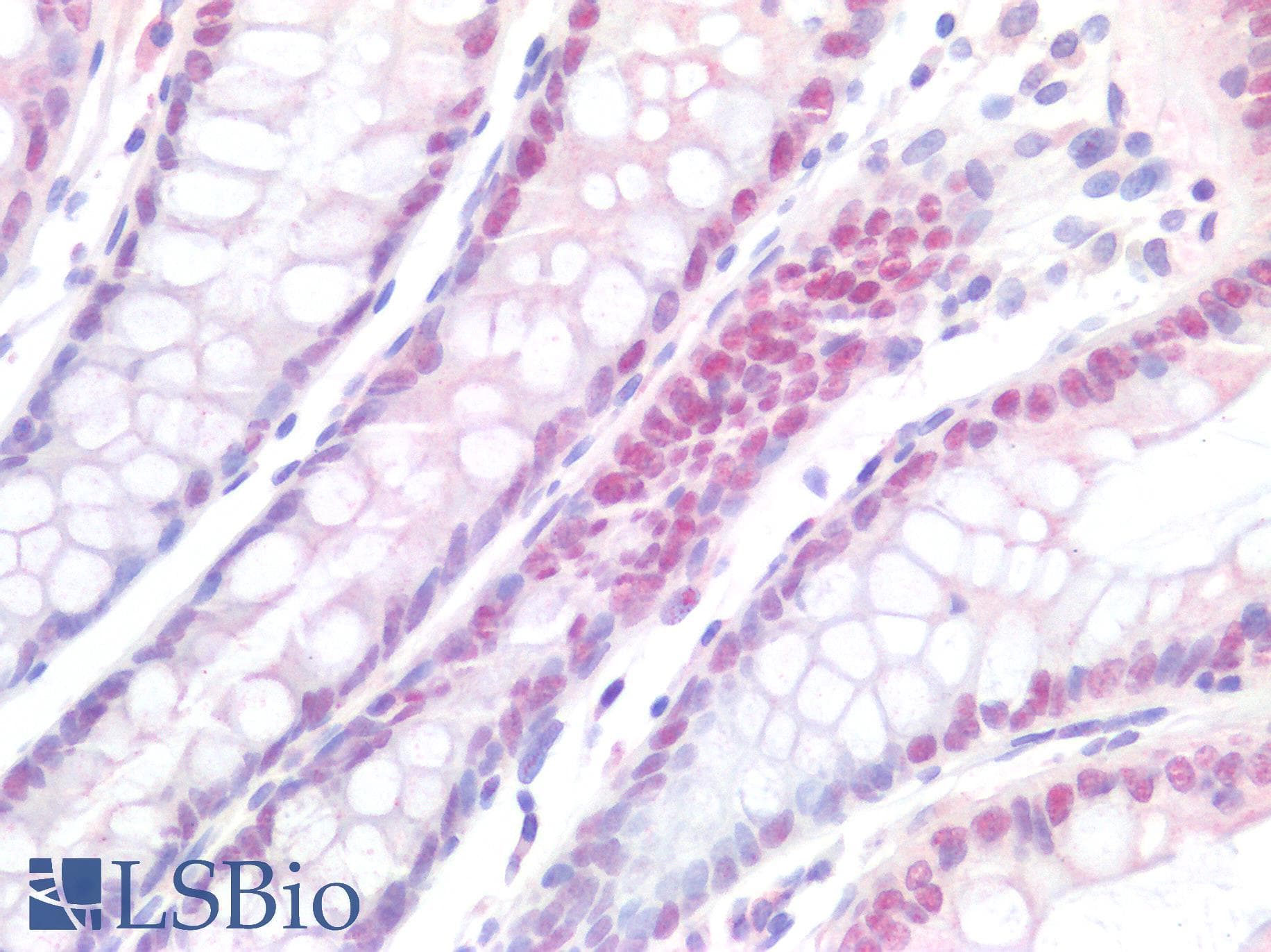 PathPlus™ HNF1B / HNF1 Beta Antibody