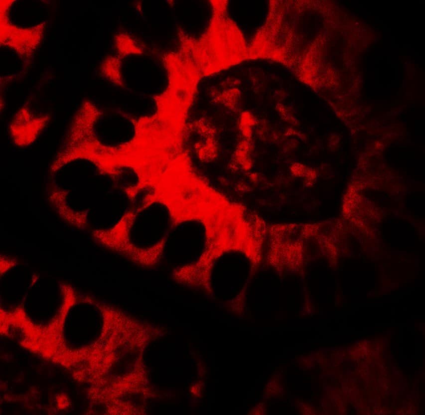 IHC-plus™ TICRR Antibody