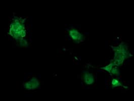 PHKG2 Antibody (clone OTI2A3)
